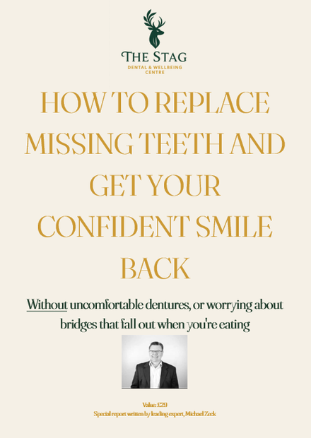 Dental Implants guide: How to replace missing teeth and get your confident smile back